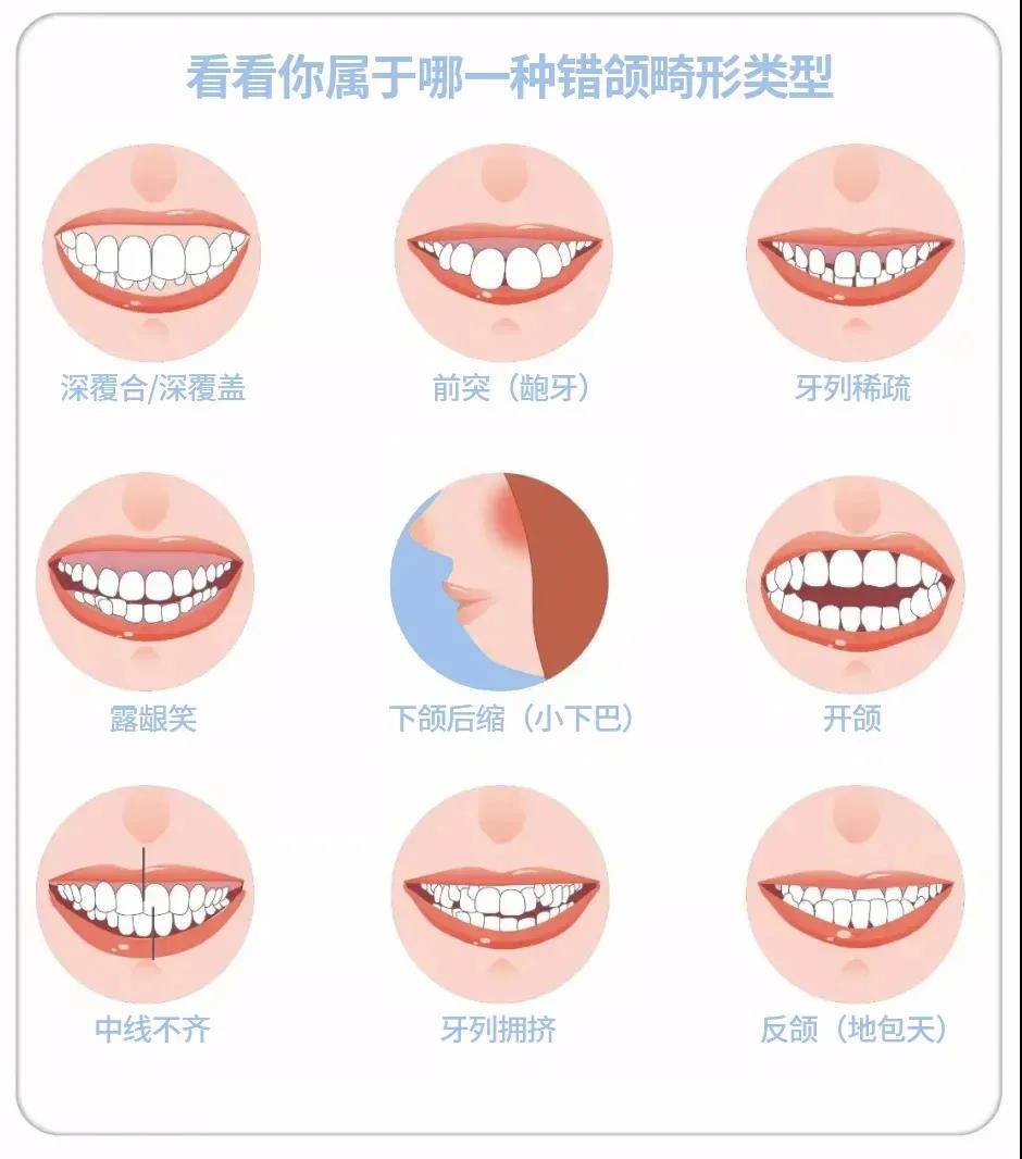 完美笑线，关于笑容的秘密 第1张
