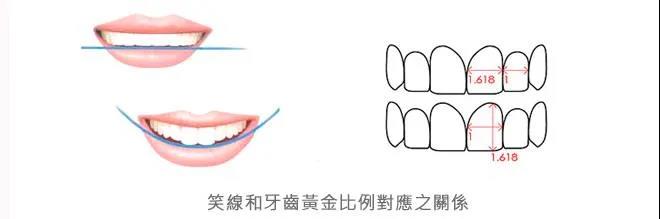 完美笑线，关于笑容的秘密 第3张