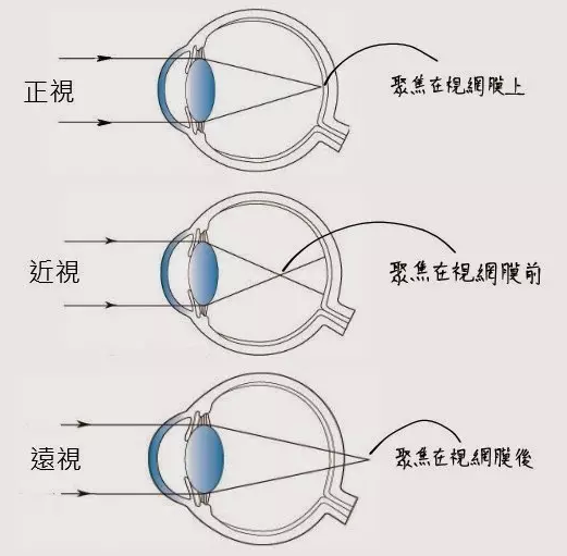 老狗啃物理8A.36（凹透镜） 第1张