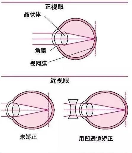 老狗啃物理8A.36（凹透镜） 第5张
