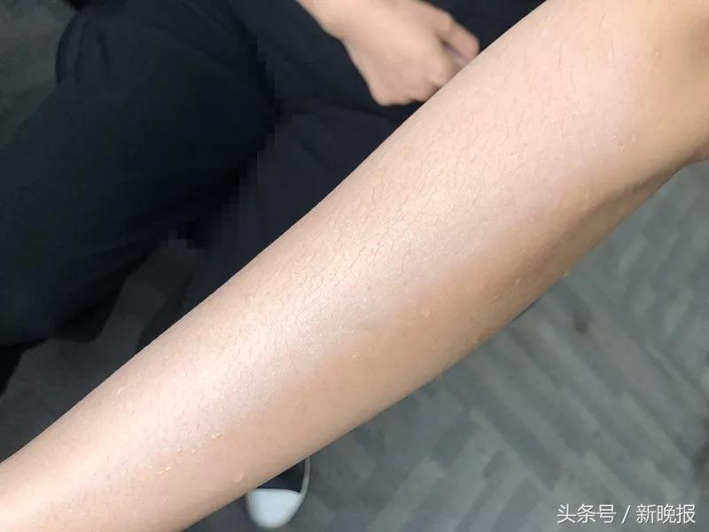 火爆抖音的“一秒变白”喷雾，你真的敢用吗？ 第25张