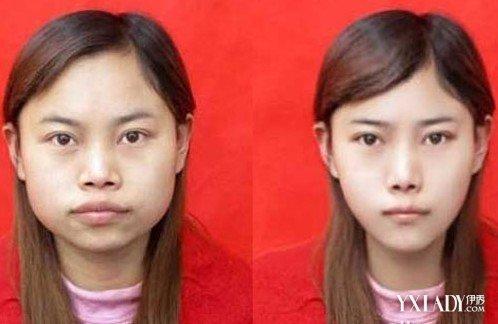 罗玉凤整容前后照片曝光 凤姐一夜成美女 第1张