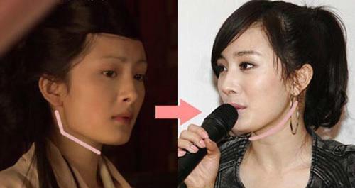 杨幂整容前后照片对比（看完你还相信杨幂没整形吗） 第5张
