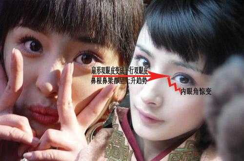 杨幂整容前后照片对比（看完你还相信杨幂没整形吗） 第7张