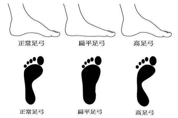 如何选择合适的跑鞋，你的跑鞋买对了吗？ 第5张