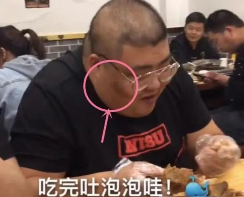 泡泡龙怎么死的（揭秘网红泡泡龙死因） 第21张