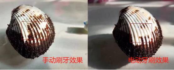 电动牙刷好不好（电动牙刷与普通牙刷的优缺点） 第5张
