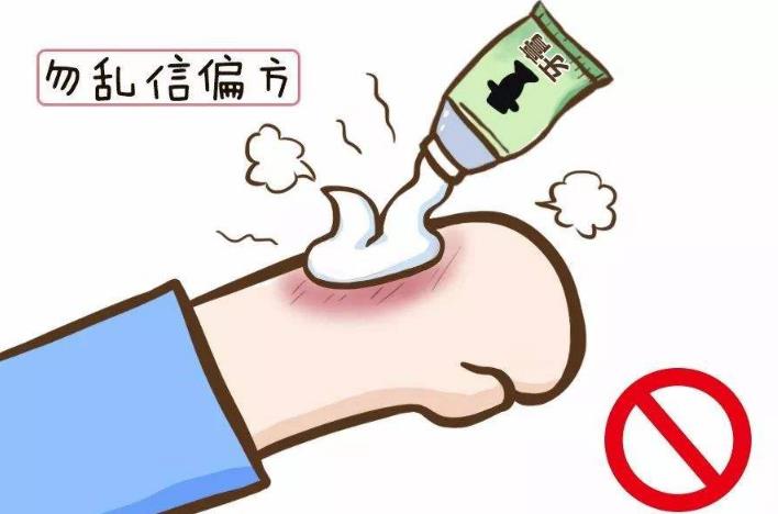 手被开水烫了怎么办可以冰敷吗（关于烫伤的处理步骤） 第7张