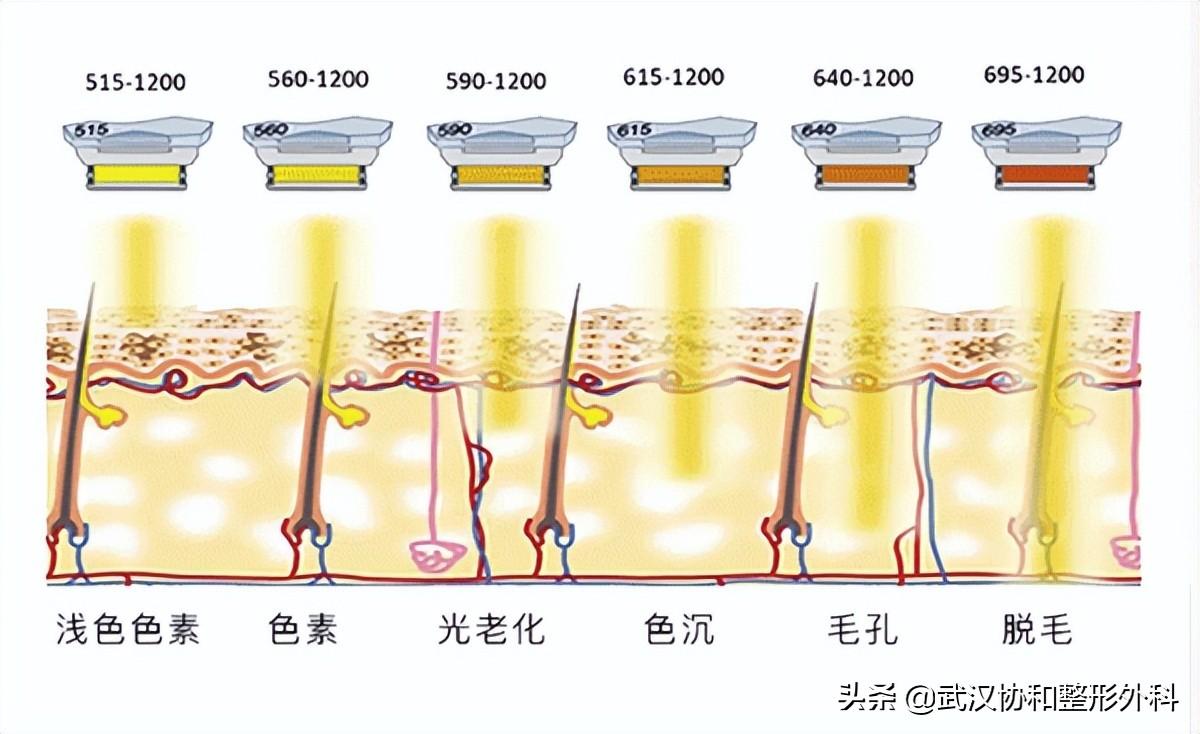 脸上的毛孔粗大是什么原因造成的（收缩毛孔最有效的办法） 第13张