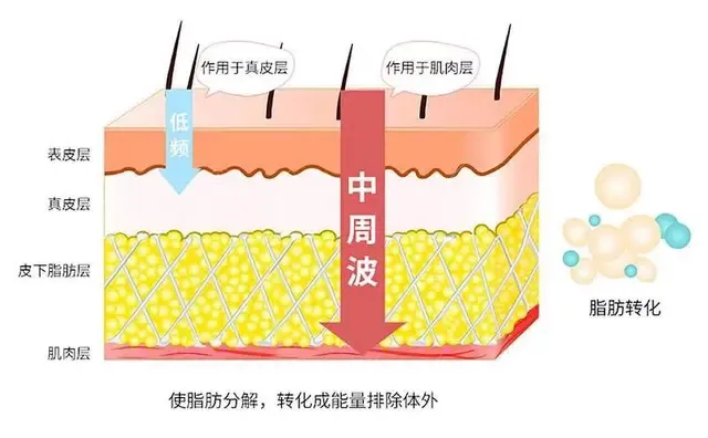 1000个跳绳消耗多少卡路里（1000跳绳相当于几公里） 第7张