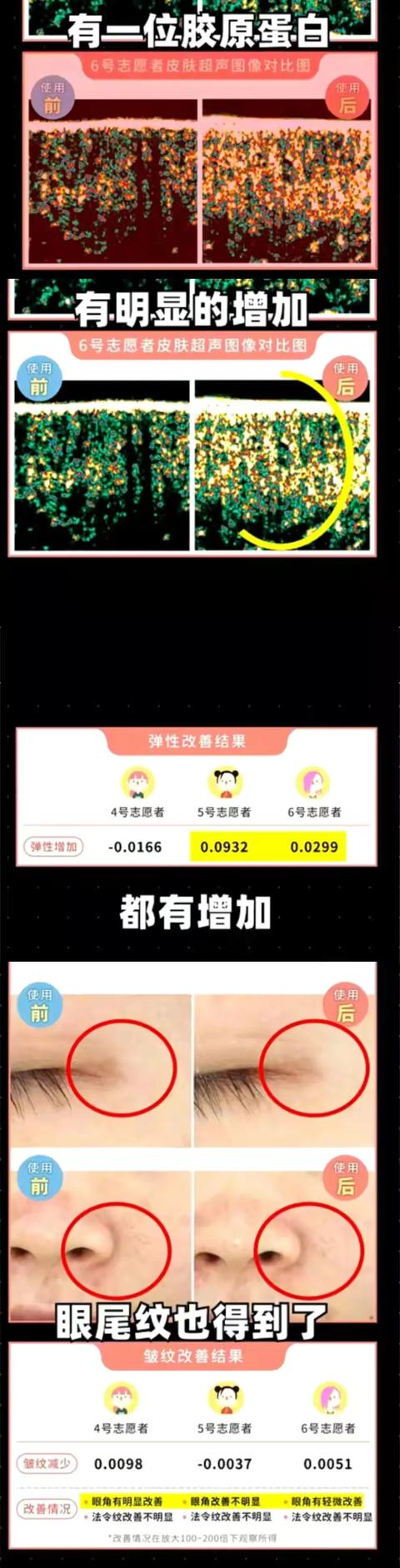 什么习惯可以改变脸型（脸型会轻易改变吗） 第21张