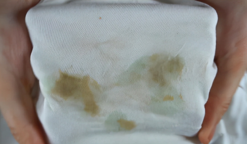 衣服上有机油怎么洗，油渍的清洗方法有哪些 第3张