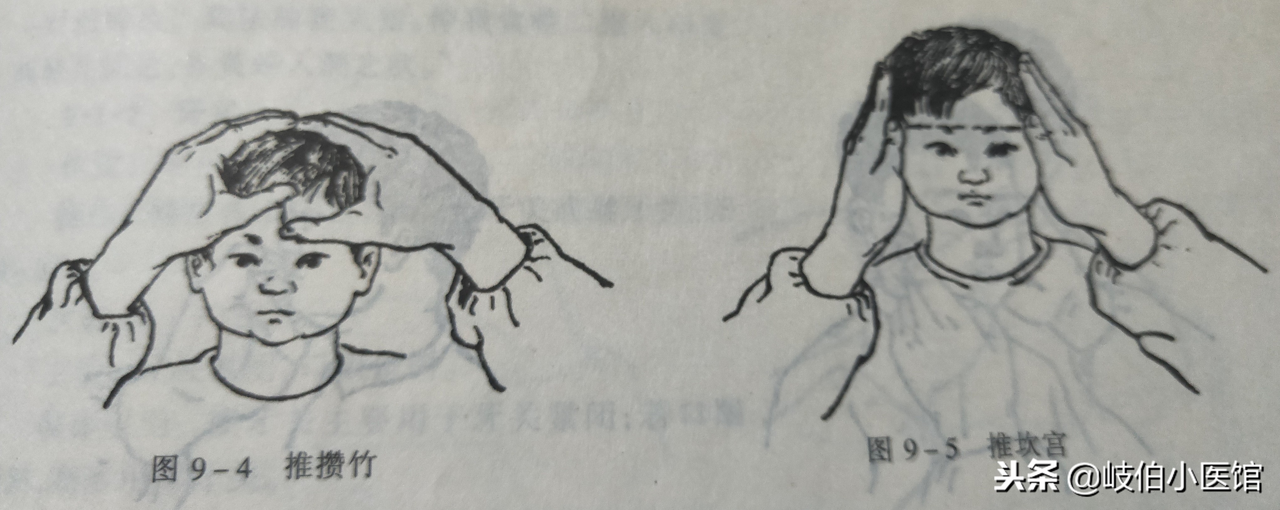 孩子高烧不退！一学就会的手法帮你物理降体温，附操作详解图示 第7张
