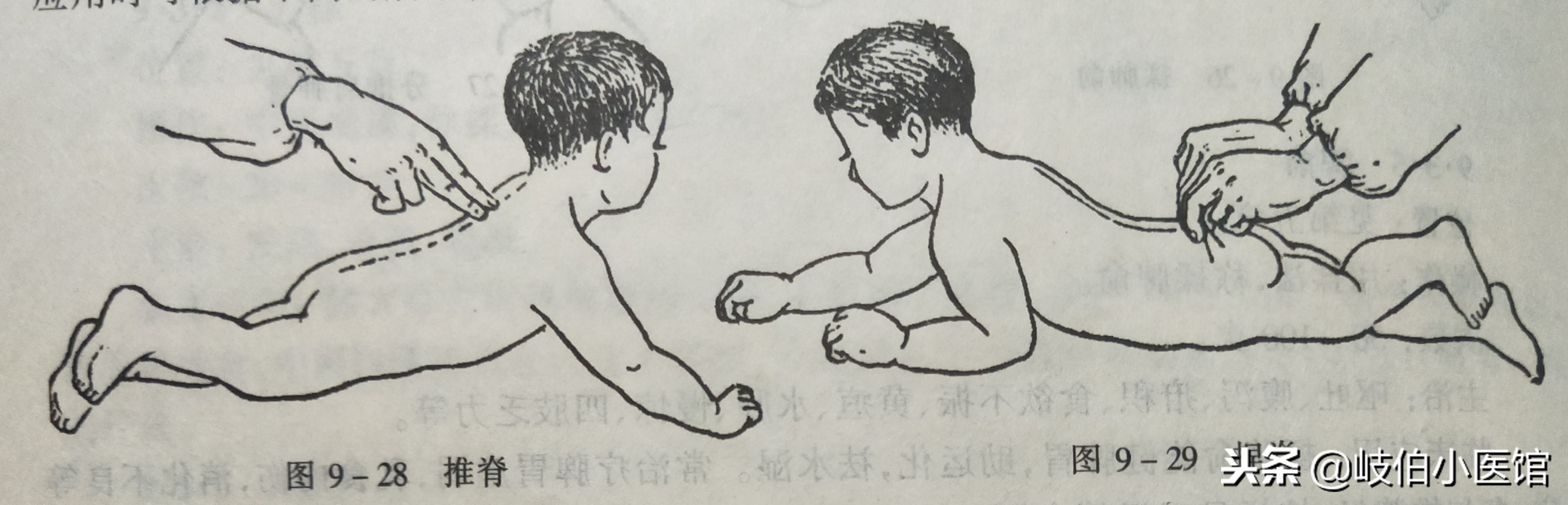 孩子高烧不退！一学就会的手法帮你物理降体温，附操作详解图示 第17张